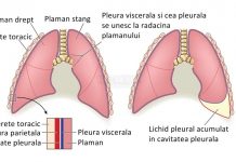 Plamanii si caracteristicile lor