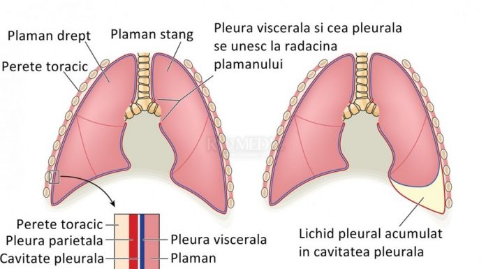 Plamanii si caracteristicile lor