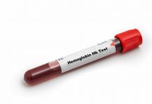 Hemoglobina: interpretarea rezultatelor, valori normale și variații
