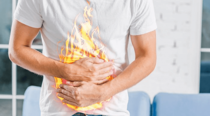 6 remedii naturale pentru arsuri la stomac